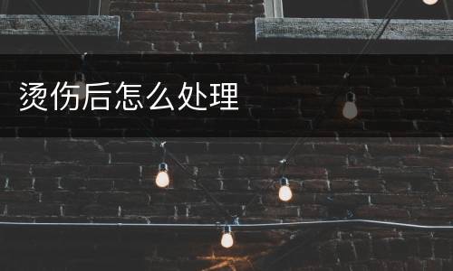 烫伤后怎么处理